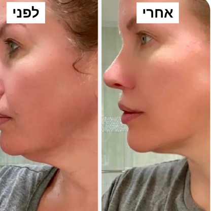 ליפט פייס - מברשת למיצוק והרמת הפנים