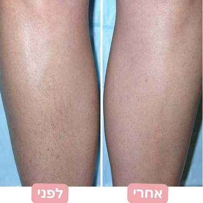 ערכת טיפוח 2 ב-1 המיועדת להסרת שיער מהגוף ומקו הביקיני
