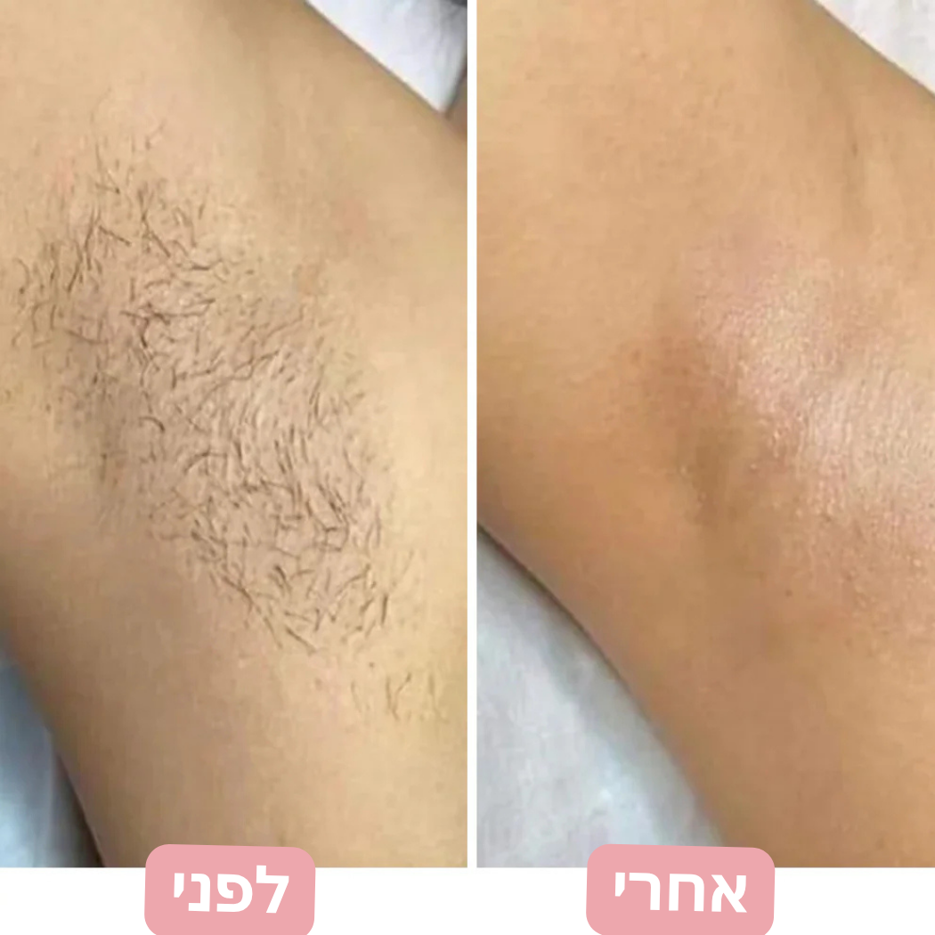ערכת טיפוח 2 ב-1 המיועדת להסרת שיער מהגוף ומקו הביקיני