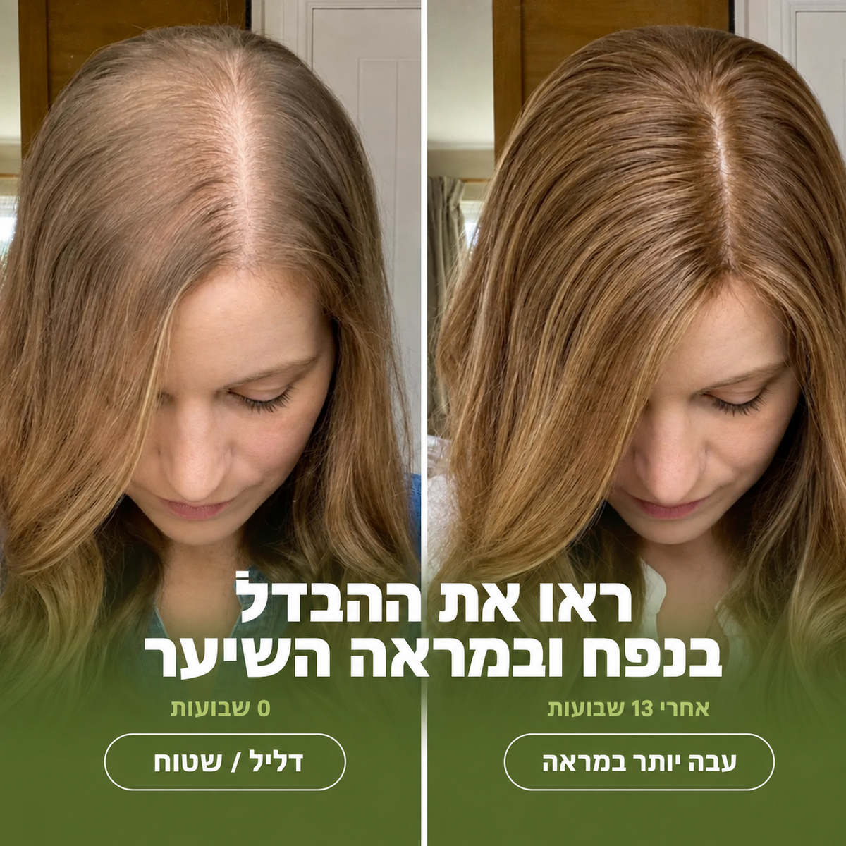שמפו מי בצל לנשירת שיער