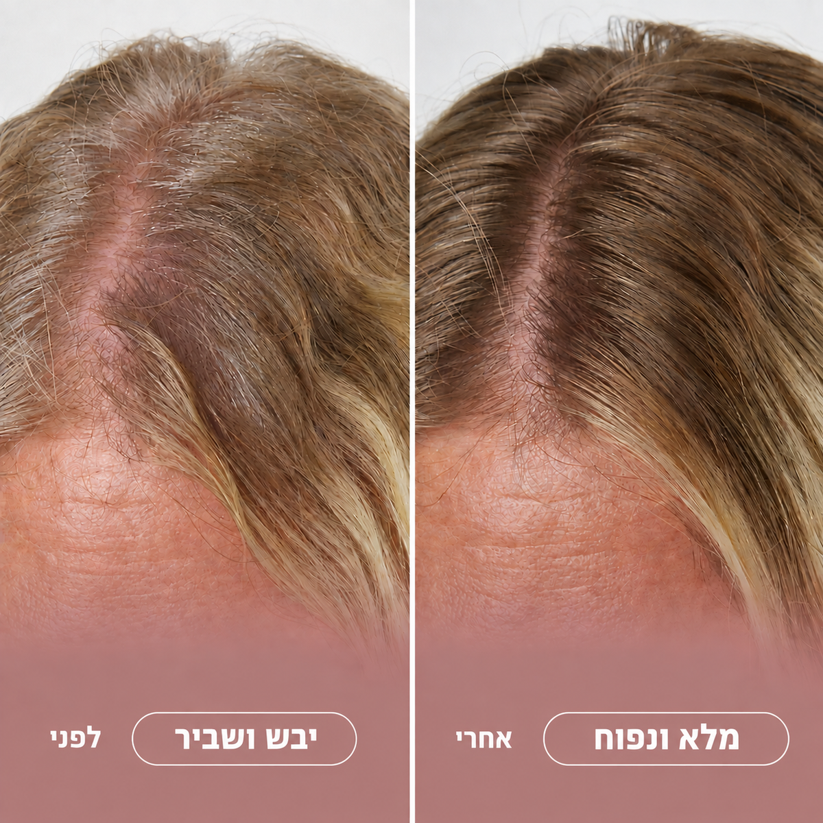 שמפו מי בצל לנשירת שיער